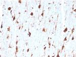 Carbonic Anhydrase VIII Monoclonal Antibody (CA8/6572)