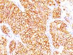 Renal Cell Carcinoma (Carbonic Anhydrase IX) Antibody in Immunohistochemistry (Paraffin) (IHC (P))