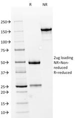 Renal Cell Carcinoma (Carbonic Anhydrase IX) Antibody in SDS-PAGE (SDS-PAGE)
