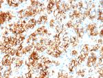 Renal Cell Carcinoma (Carbonic Anhydrase IX) Recombinant Mouse Monoclonal Antibody (rPN-15)