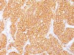 Renal Cell Carcinoma/gp200 (Carbonic Anhydrase IX) Antibody in Immunohistochemistry (Paraffin) (IHC (P))