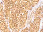 Renal Cell Carcinoma/gp200 (Carbonic Anhydrase IX) Antibody in Immunohistochemistry (Paraffin) (IHC (P))