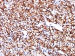 Carbonic Anhydrase IX Antibody in Immunohistochemistry (Paraffin) (IHC (P))