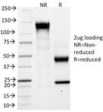 Carbonic Anhydrase IX Antibody in SDS-PAGE (SDS-PAGE)