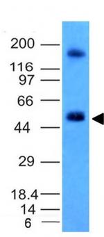 Carbonic Anhydrase IX Antibody in Western Blot (WB)