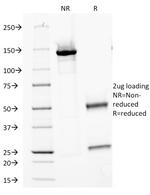 Proximal Nephrogenic Antigen (Carbonic Anhydrase IX) Antibody in SDS-PAGE (SDS-PAGE)