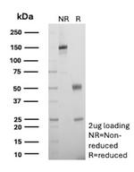 Renal Cell Carcinoma (Carbonic Anhydrase IX) Antibody in SDS-PAGE (SDS-PAGE)