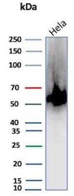 Renal Cell Carcinoma (Carbonic Anhydrase IX) Antibody in Western Blot (WB)