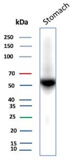 Renal Cell Carcinoma (Carbonic Anhydrase IX) Antibody in Western Blot (WB)