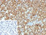 Renal Cell Carcinoma (Carbonic Anhydrase IX) Recombinant Mouse Monoclonal Antibody (rCA9/9937)