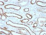 Renal Cell Carcinoma (Carbonic Anhydrase IX) Monoclonal Antibody (CA9/3405)