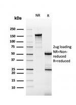 Renal Cell Carcinoma (Carbonic Anhydrase IX) Antibody in SDS-PAGE (SDS-PAGE)