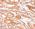Renal Cell Carcinoma (Carbonic Anhydrase IX) Monoclonal Antibody (CA9/3406)