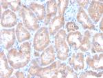 Renal Cell Carcinoma (Carbonic Anhydrase IX) Antibody in Immunohistochemistry (Paraffin) (IHC (P))
