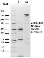 Renal Cell Carcinoma (Carbonic Anhydrase IX) Antibody in SDS-PAGE (SDS-PAGE)