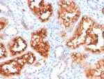 Renal Cell Carcinoma (Carbonic Anhydrase IX) Antibody in Immunohistochemistry (Paraffin) (IHC (P))