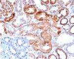 Renal Cell Carcinoma (Carbonic Anhydrase IX) Antibody in Immunohistochemistry (Paraffin) (IHC (P))