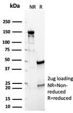 Renal Cell Carcinoma (Carbonic Anhydrase IX) Antibody in SDS-PAGE (SDS-PAGE)