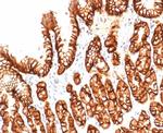 Renal Cell Carcinoma (Carbonic Anhydrase IX) Antibody in Immunohistochemistry (Paraffin) (IHC (P))