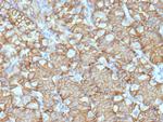 Renal Cell Carcinoma (Carbonic Anhydrase IX) Antibody in Immunohistochemistry (Paraffin) (IHC (P))