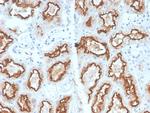 Renal Cell Carcinoma (Carbonic Anhydrase IX) Recombinant Rabbit Monoclonal Antibody (CA9, 2993R)