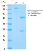 Renal Cell Carcinoma (Carbonic Anhydrase IX) Antibody in SDS-PAGE (SDS-PAGE)