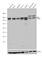 BRD8 Recombinant Superclonal™ Antibody (1HCLC)