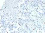 ZNF232 (Transcription Factor) Monoclonal Antibody (PCRP-ZNF232-2B3)