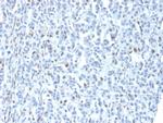 ZNF232 (Transcription Factor) Monoclonal Antibody (PCRP-ZNF232-1D5)