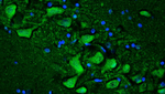 Ryanodine Receptor Type 2 (RyR2) Antibody in Immunohistochemistry (IHC)