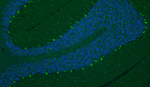 Cav1.2 Ca2+ Channel Antibody in Immunohistochemistry (IHC)