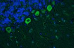 Cav1.2 Ca2+ Channel Antibody in Immunohistochemistry (IHC)
