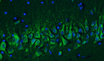 Cav1.2 Ca2+ Channel Recombinant Chicken Monoclonal Antibody (N500/4)