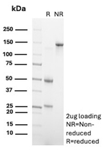 PAX8 (Renal Cell Marker) Antibody in SDS-PAGE (SDS-PAGE)