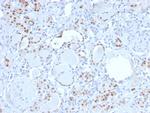 PAX8 (Renal Cell Marker) Recombinant Rabbit Monoclonal Antibody (PAX8/3688R)