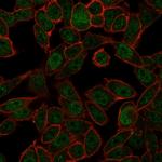 Nucleolar complex-associated protein 4-like protein (NOC4L) Monoclonal Antibody (PCRP-NOC4L-1E3)