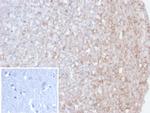 Calretinin/Calbindin 2 (Mesothelioma Marker) Antibody in Immunohistochemistry (Paraffin) (IHC (P))