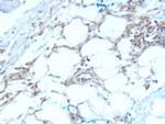 Calretinin/Calbindin 2 (Mesothelioma Marker) Monoclonal Antibody (CALB2/2603)