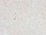 Calretinin/Calbindin 2 (Mesothelioma Marker) Antibody in Immunohistochemistry (Paraffin) (IHC (P))