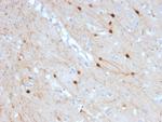 Calretinin/Calbindin 2 (Mesothelioma Marker) Antibody in Immunohistochemistry (Paraffin) (IHC (P))