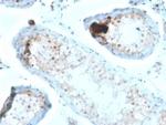 Calretinin/Calbindin 2 (Mesothelioma Marker) Antibody in Immunohistochemistry (Paraffin) (IHC (P))