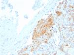 Calretinin/Calbindin 2 (Mesothelioma Marker) Antibody in Immunohistochemistry (Paraffin) (IHC (P))