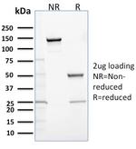 Calretinin/Calbindin 2 (Mesothelioma Marker) Antibody in SDS-PAGE (SDS-PAGE)