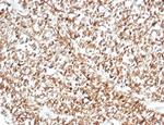 Calretinin/Calbindin 2 (Mesothelioma Marker) Recombinant Rabbit Monoclonal Antibody (CALB2/7029R)