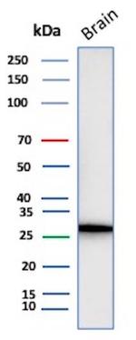 Calretinin/Calbindin 2 (Mesothelioma Marker) Recombinant Rabbit Monoclonal Antibody (CALB2/4688R)