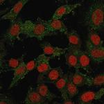 B7-H4 (Immuno-Inhibitory Protein) Recombinant Rabbit Monoclonal Antibody (B7H4, 2652R)