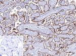 TFPI2 (Marker of Ovarian Carcinoma) Monoclonal Antibody (TFPI2/13025)