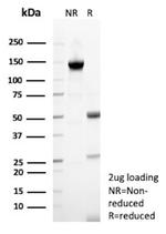 TFPI2 (Marker of Ovarian Carcinoma) Antibody in SDS-PAGE (SDS-PAGE)