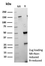 TFPI2 (Marker of Ovarian Carcinoma) Antibody in SDS-PAGE (SDS-PAGE)