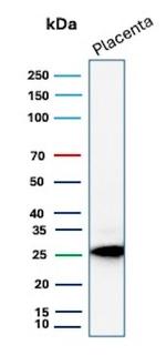 TFPI2 (Marker of Ovarian Carcinoma) Antibody in Western Blot (WB)